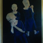 Albinos